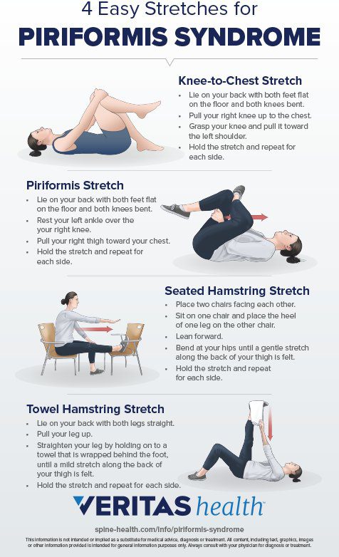 How to relieve Piriformis Syndrome pain | The Reading Chiropractor